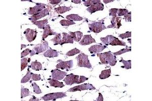 Immunohistochemistry (IHC) image for anti-Neurotrophic Tyrosine Kinase, Receptor, Type 1 (NTRK1) (AA 769-796) antibody (ABIN3031984)