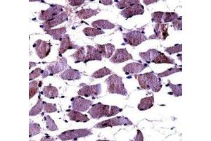 TrkA antibody immunohistochemistry analysis in formalin fixed and paraffin embedded human skeletal muscle. (TRKA 抗体  (AA 769-796))