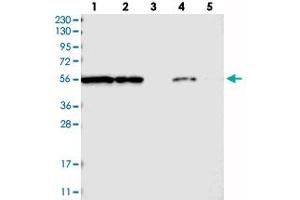 Western blot analysis of Lane 1: RT-4, Lane 2: U-251 MG, Lane 3: Human Plasma, Lane 4: Liver, Lane 5: Tonsil with FKBP9 polyclonal antibody  at 1:250-1:500 dilution. (FKBP9 抗体)