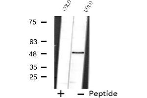 Western blot analysis of extracts from COLO cells using PRPF19 antibody. (PRP19 抗体  (N-Term))