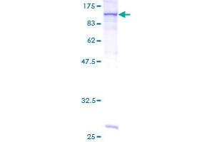 Image no. 2 for Feline Sarcoma Oncogene (FES) (AA 1-822) protein (GST tag) (ABIN1353967)