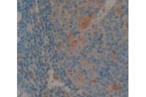 IHC-P analysis of Human Tissue, with DAB staining. (IL1F9 抗体  (AA 1-158))
