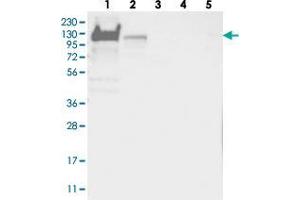 Western blot analysis of Lane 1: RT-4, Lane 2: U-251 MG, Lane 3: Human Plasma, Lane 4: Liver, Lane 5: Tonsil with YTHDC1 polyclonal antibody  at 1:250-1:500 dilution. (YTHDC1 抗体)