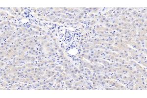 Detection of CRP in Bovine Liver Tissue using Polyclonal Antibody to C Reactive Protein (CRP) (CRP 抗体  (AA 14-224))