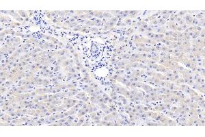 Detection of CRP in Bovine Liver Tissue using Polyclonal Antibody to C Reactive Protein (CRP) (CRP 抗体  (AA 14-224))