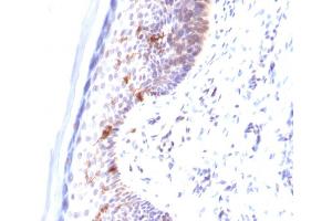 Formalin-fixed, paraffin-embedded human Skin stained with CD1a Mouse Monoclonal Antibody (C1A/711). (CD1a 抗体)