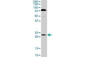TRIM55 MaxPab rabbit polyclonal antibody. (TRIM55 抗体  (AA 1-452))