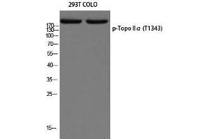 Western Blot (WB) analysis of 293T COLO205 using p-Topo IIalpha (T1343) antibody. (Topo IIalpha (pThr1343) 抗体)