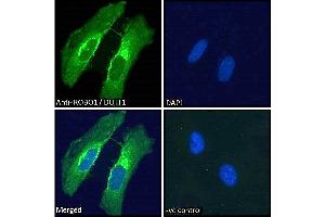 ABIN185537 Immunofluorescence analysis of paraformaldehyde fixed HeLa cells, permeabilized with 0. (ROBO1 抗体  (Internal Region))