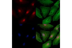Phospho-NLRC4 (Ser533) Antibody staining A549 cells(heat shock treatment) by IF/ICC. (NLRC4 抗体  (pSer533))