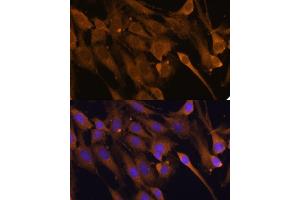 Immunofluorescence (IF) image for anti-STIP1 Homology and U-Box Containing Protein 1 (STUB1) (AA 1-303) antibody (ABIN6148649)