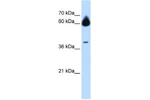 MMP23B antibody used at 1 ug/ml to detect target protein. (MMP23B 抗体  (N-Term))
