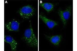 Immunofluorescent staining of Chloroquine (50 uM, 16h) treated (A) and untreated (B) HeLa cells with MAP1LC3A (Cleaved) polyclonal antibody  shows vesicles staining at 1: 25 dilution. (MAP1LC3A 抗体  (AA 89-120))