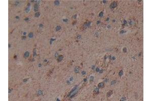 Immunohistochemistry (IHC) image for anti-Citrate Synthase (CS) (AA 103-394) antibody (ABIN7440647)