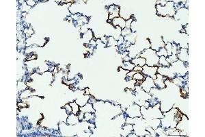 IHC analysis of RAGE/AGER using anti-RAGE/AGER antibody (ABIN7601722). (RAGE 抗体  (AA 43-404))