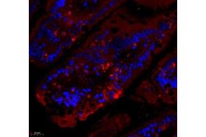 Immunofluorescence (Paraffin-embedded Sections) (IF (p)) image for anti-Tumor Necrosis Factor Receptor Superfamily, Member 6b, Decoy (TNFRSF6B) antibody (ABIN7076071)