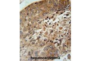 Immunohistochemistry (Paraffin-embedded Sections) (IHC (p)) image for anti-Acyl-CoA Dehydrogenase Family, Member 10 (ACAD10) (AA 396-425), (Middle Region) antibody (ABIN950222)