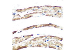 Immunohistochemistry of paraffin-embedded rat heart using Fbx32/FBOX32 Rabbit mAb (ABIN7267090) at dilution of 1:100 (40x lens). (FBXO32 抗体)
