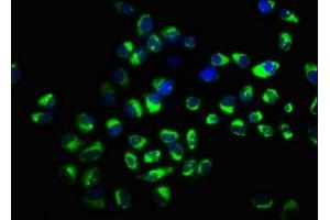 Immunofluorescence staining of Hela cells with ABIN7170299 at 1:166, counter-stained with DAPI. (SLCO2A1 抗体  (AA 416-518))