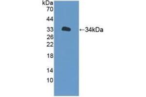 Detection of Recombinant XYLT2, Human using Polyclonal Antibody to Xylosyltransferase II (XYLT2)