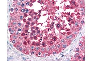 Anti-HSPA4L antibody IHC of human testis. (HSPA4L 抗体  (AA 825-839))