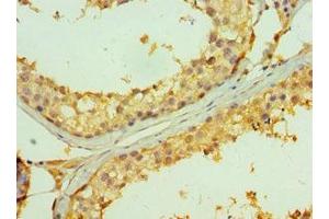 Immunohistochemistry of paraffin-embedded human testis tissue using ABIN7173851 at dilution of 1:100