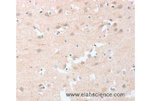 Immunohistochemistry of Human brain  using LY96 Polyclonal Antibody at dilution of 1:20 (LY96 抗体)
