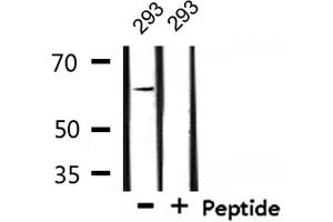 Western blot analysis of extracts from 293, using TGFR2 Antibody. (TGFBR2 抗体  (Internal Region))