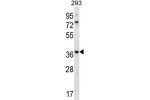 Western Blotting (WB) image for anti-Olfactory Receptor, Family 6, Subfamily X, Member 1 (OR6X1) antibody (ABIN2996693) (OR6X1 抗体)