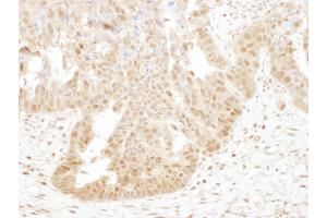 Immunohistochemistry (IHC) image for anti-Proteasome (Prosome, Macropain) Subunit, beta Type, 4 (PSMB4) (AA 214-264) antibody (ABIN7453542)