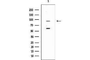 anti-WD Repeat Domain 70 (WDR70) antibody