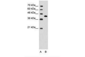 Image no. 2 for anti-Carcinoembryonic Antigen-Related Cell Adhesion Molecule 6 (CEACAM6) (AA 216-265) antibody (ABIN203400) (CEACAM6 抗体  (AA 216-265))