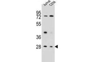 Western Blotting (WB) image for anti-Tetraspanin 26 (TSPAN26) antibody (ABIN2995796) (CD37 抗体)