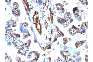 Immunohistochemistry (IHC) image for anti-Moesin (MSN) antibody (ABIN6940082)