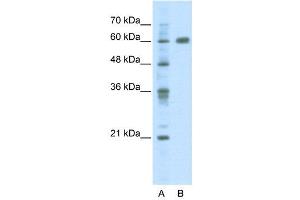 WB Suggested Anti-PDLIM5  Antibody Titration: 2. (PDLIM5 抗体  (C-Term))