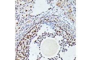 Immunohistochemistry of paraffin-embedded rat ovary using [KO Validated] CDK4 Rabbit mAb  at dilution of 1:100 (40x lens). (CDK4 抗体)