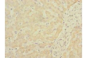 Immunohistochemistry of paraffin-embedded human liver tissue using ABIN7170777 at dilution of 1:100 (SOAT2 抗体  (AA 1-120))