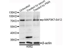 Western blot analysis of extracts of K-562 cells, using Phospho-MAP3K7-S412 antibody (ABIN5995645) at 1/1000 dilution. (MAP3K7 抗体  (pSer439))