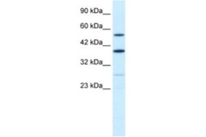 Western Blotting (WB) image for anti-A Kinase (PRKA) Anchor Protein 17A (AKAP17A) antibody (ABIN2460894) (SFRS17A 抗体)