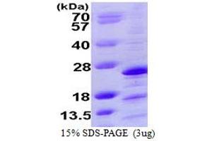 SDS-PAGE (SDS) image for NADH Dehydrogenase (Ubiquinone) 1 alpha Subcomplex, Assembly Factor 2 (NDUFAF2) (AA 1-169) protein (His tag) (ABIN7529172)