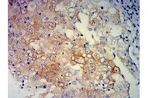 Immunohistochemistry (IHC) image for anti-Excision Repair Cross Complementing Polypeptide-1 (ERCC1) (AA 1-297) antibody (ABIN7193699)