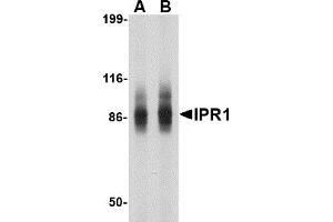 Western Blotting (WB) image for anti-SP110 Nuclear Body Protein (SP110) (N-Term) antibody (ABIN1031418) (SP110 抗体  (N-Term))