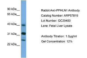 WB Suggested Anti-PPHLN1  Antibody Titration: 0. (PPHLN1 抗体  (N-Term))
