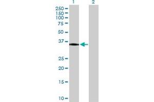 Western Blot analysis of HLA-DRA expression in transfected 293T cell line by HLA-DRA MaxPab polyclonal antibody. (HLA-DRA 抗体  (AA 1-254))