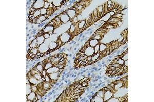 Immunohistochemistry of paraffin-embedded human colon using CLDN3 antibody (ABIN3017039, ABIN3017040, ABIN3017041, ABIN1679261 and ABIN6219930) (40x lens). (Claudin 3 抗体)