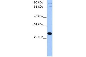 Western Blotting (WB) image for anti-Thyroid Hormone Receptor Associated Protein 3 Pseudogene 1 (THRAP3P1) antibody (ABIN2459455) (THRAP3P1 抗体)