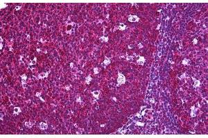Human Tonsil: Formalin-Fixed, Paraffin-Embedded (FFPE) (FLIP 抗体  (AA 178-277))