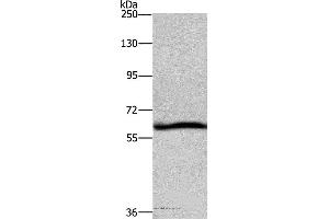 Western blot analysis of Hela cell, using DCP1A Polyclonal Antibody at dilution of 1:1100 (DCP1A 抗体)