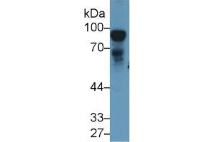 Detection of NEXN in Rat Testis lysate using Polyclonal Antibody to Nexilin (NEXN)