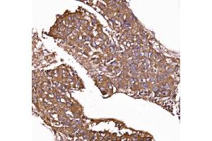 IHC analysis of GPR54/KISS1R using anti-GPR54/KISS1R antibody (ABIN7602153).